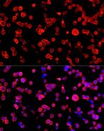 NSE Antibody in Immunocytochemistry (ICC/IF)