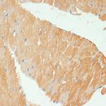 MYBPC3 Polyclonal Antibody