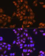 UBE1 Polyclonal Antibody