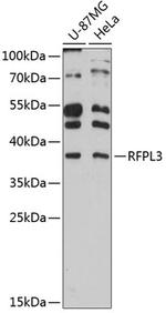RFPL3 Polyclonal Antibody
