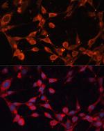 SLC25A19 Polyclonal Antibody