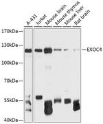 EXOC4 Polyclonal Antibody