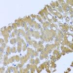 Acid Phosphatase 1 Polyclonal Antibody