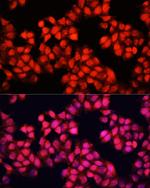 ALAD Polyclonal Antibody