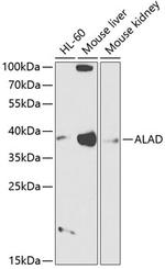 ALAD Antibody in Western Blot (WB)