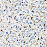 beta-2 Microglobulin Polyclonal Antibody