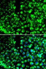 Calumenin Polyclonal Antibody