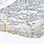 Trypsin Antibody in Immunohistochemistry (Paraffin) (IHC (P))