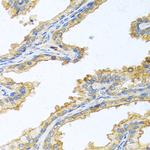 Trypsin Antibody in Immunohistochemistry (Paraffin) (IHC (P))
