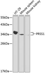 Trypsin Antibody in Western Blot (WB)