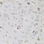 CEACAM5 Antibody in Immunohistochemistry (Paraffin) (IHC (P))