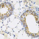 CEACAM5 Antibody in Immunohistochemistry (Paraffin) (IHC (P))