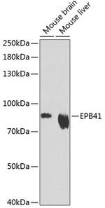 EPB41 Antibody in Western Blot (WB)
