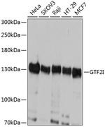 GTF2I Antibody in Western Blot (WB)