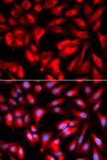 RHAMM Antibody in Immunocytochemistry (ICC/IF)