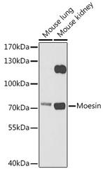Moesin Antibody in Western Blot (WB)
