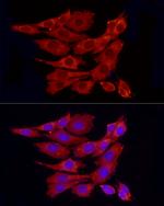 PP1 alpha Polyclonal Antibody