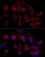 Moesin Antibody in Immunocytochemistry (ICC/IF)