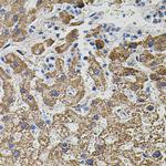 NTF3 Polyclonal Antibody