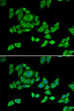OGDH Polyclonal Antibody