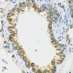 PI3 Antibody in Immunohistochemistry (Paraffin) (IHC (P))