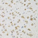 PI3 Antibody in Immunohistochemistry (Paraffin) (IHC (P))