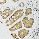 PI3 Antibody in Immunohistochemistry (Paraffin) (IHC (P))