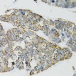 PI3 Antibody in Immunohistochemistry (Paraffin) (IHC (P))