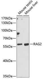 RAG2 Polyclonal Antibody