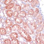 SHMT1 Antibody in Immunohistochemistry (Paraffin) (IHC (P))