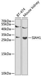 SIAH1 Polyclonal Antibody