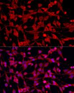 PEX5 Antibody in Immunocytochemistry (ICC/IF)
