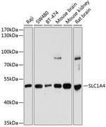 SLC1A4 Polyclonal Antibody