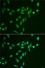 SRPK1 Antibody in Immunocytochemistry (ICC/IF)