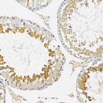 SRPK1 Antibody in Immunohistochemistry (Paraffin) (IHC (P))