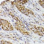 COX2 Polyclonal Antibody