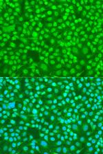 SRSF9 Polyclonal Antibody