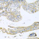 HDAC3 Antibody in Immunohistochemistry (Paraffin) (IHC (P))