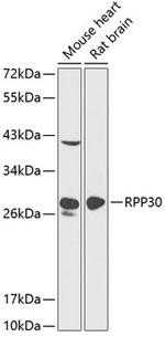 RPP30 Antibody in Western Blot (WB)