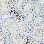 GABARAP Polyclonal Antibody