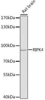 RIPK4 Antibody in Western Blot (WB)