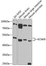 KCNK9 Polyclonal Antibody