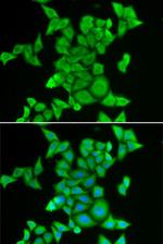 STRN3 Polyclonal Antibody