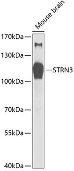 STRN3 Antibody in Western Blot (WB)