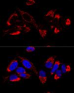 UCRC Polyclonal Antibody