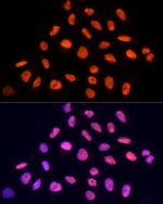 PRP19 Polyclonal Antibody