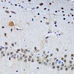 Livin Antibody in Immunohistochemistry (Paraffin) (IHC (P))