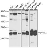 DNAL1 Polyclonal Antibody