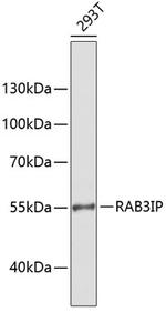 RAB3IP Antibody in Western Blot (WB)