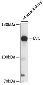 EVC Polyclonal Antibody